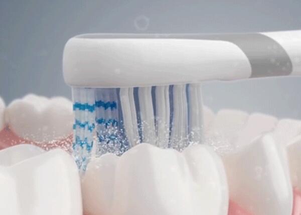 電動牙刷刷牙好嗎？真的比手動牙刷更好嗎？
